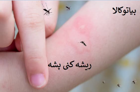 از بین بردن پشه ها 