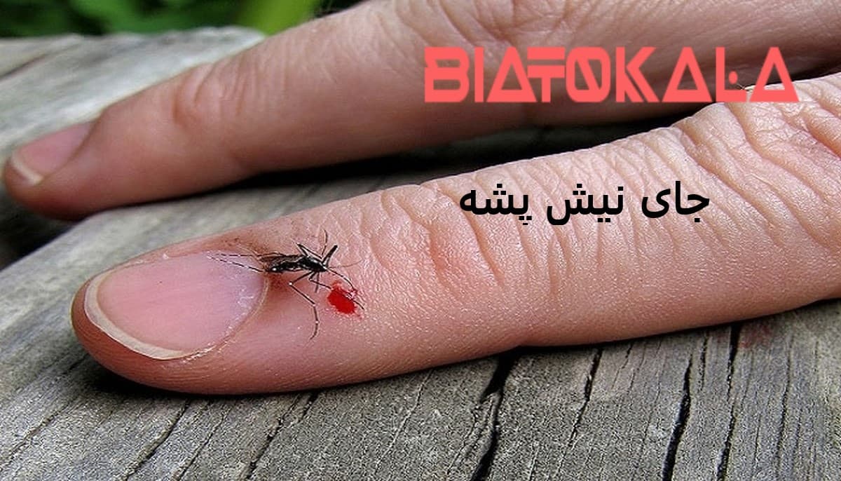 جای نیش پشه و خطرات نیش پشه