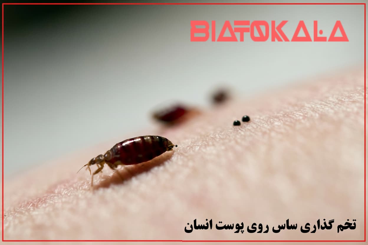 ایا ساس ها در لباس میتوانند تخم گذاری کنند 