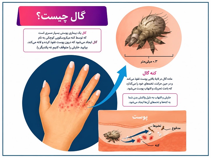 گال روی پوست تخم گذاری میکند؟