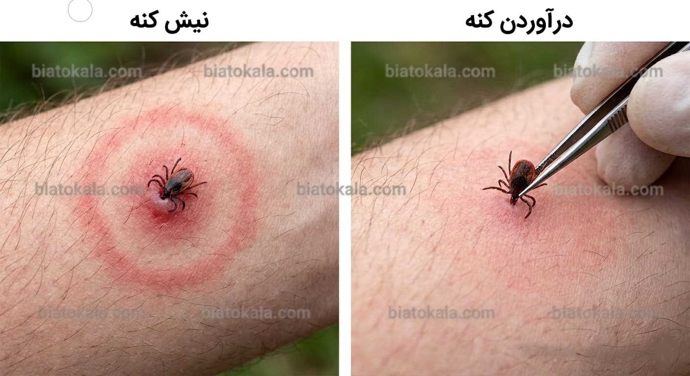 کنه و نیش کنه 