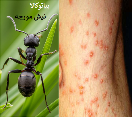 نیش مورچه