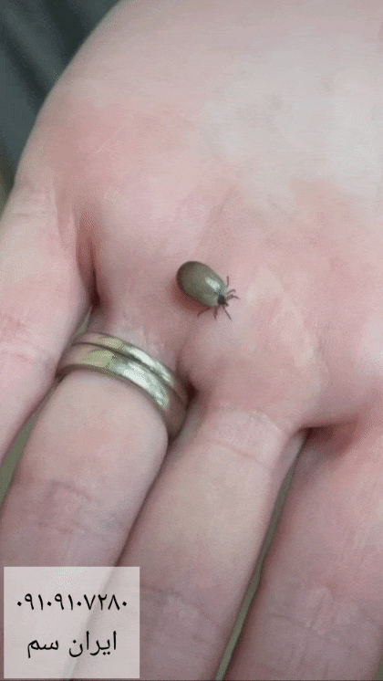 کنه روی دست انسان