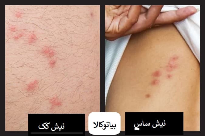 مقایسه و تفاوت نیش ساس