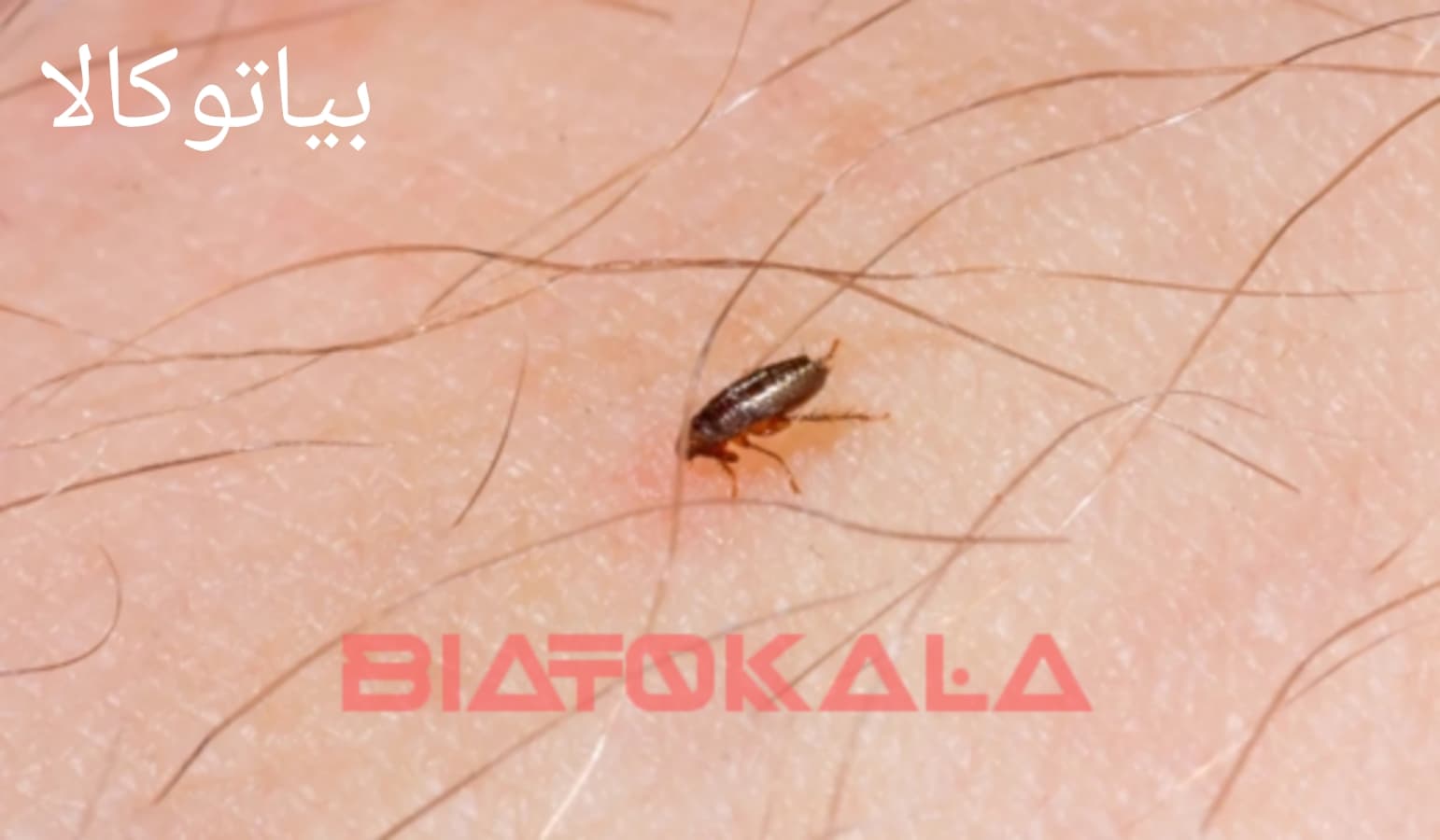 ریشه کنی کک