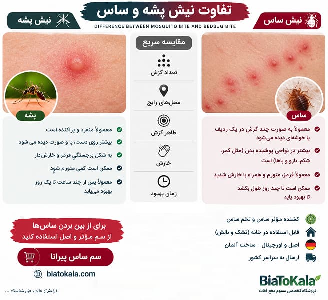 تفاوت نیش ساس و پشه