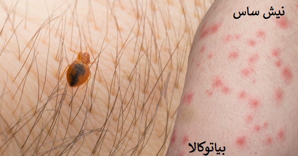 نیش ساس