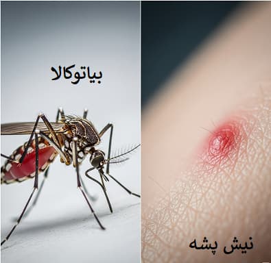 نیش پشه