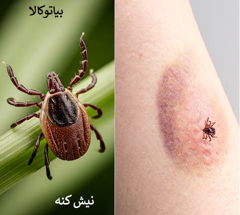 نیش کنه